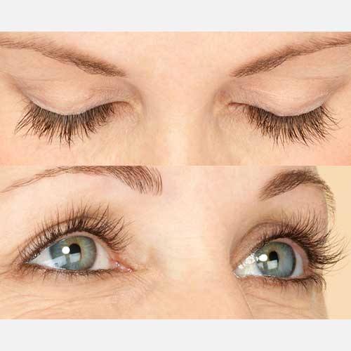 Latisse Eyelash After